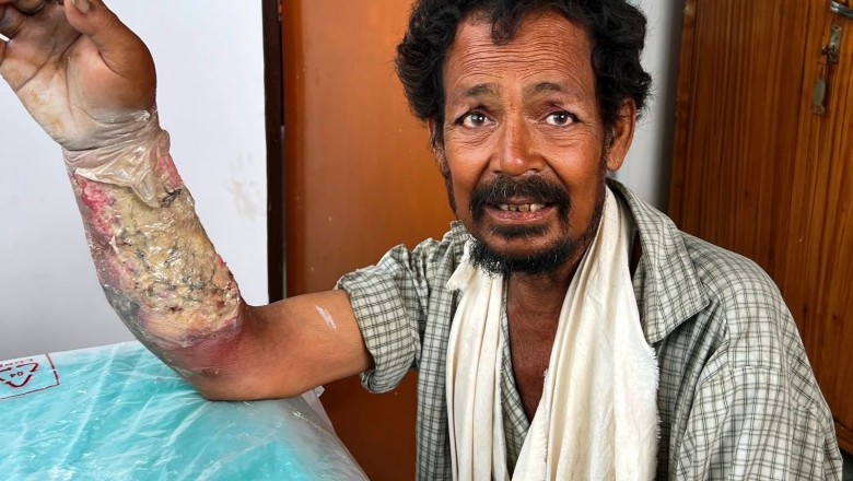 राजू  को  मिला  नया  जीवन; अब है स्वस्थ; डीएम स्वयं कर रहे थे मॉनीटरिंग