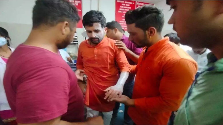 रैली के दौरान धमाका: गैस के गुब्बारे फटने से मची अफरा-तफरी, भाजपा युवा मोर्चा के प्रदेश अध्यक्ष घायल