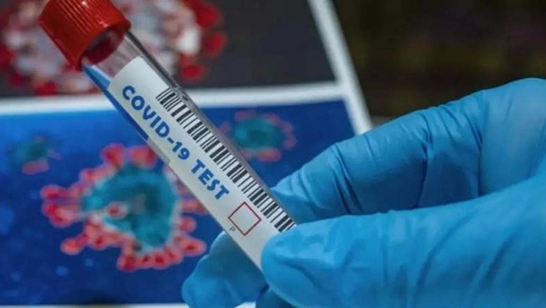 UP: कोरोना संक्रमित विदेशी पर्यटक हुआ लापता, पता लिया नहीं, अब उसे होटलों में ढूंढा जा रहा